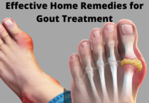 gout treatment-write to aspire